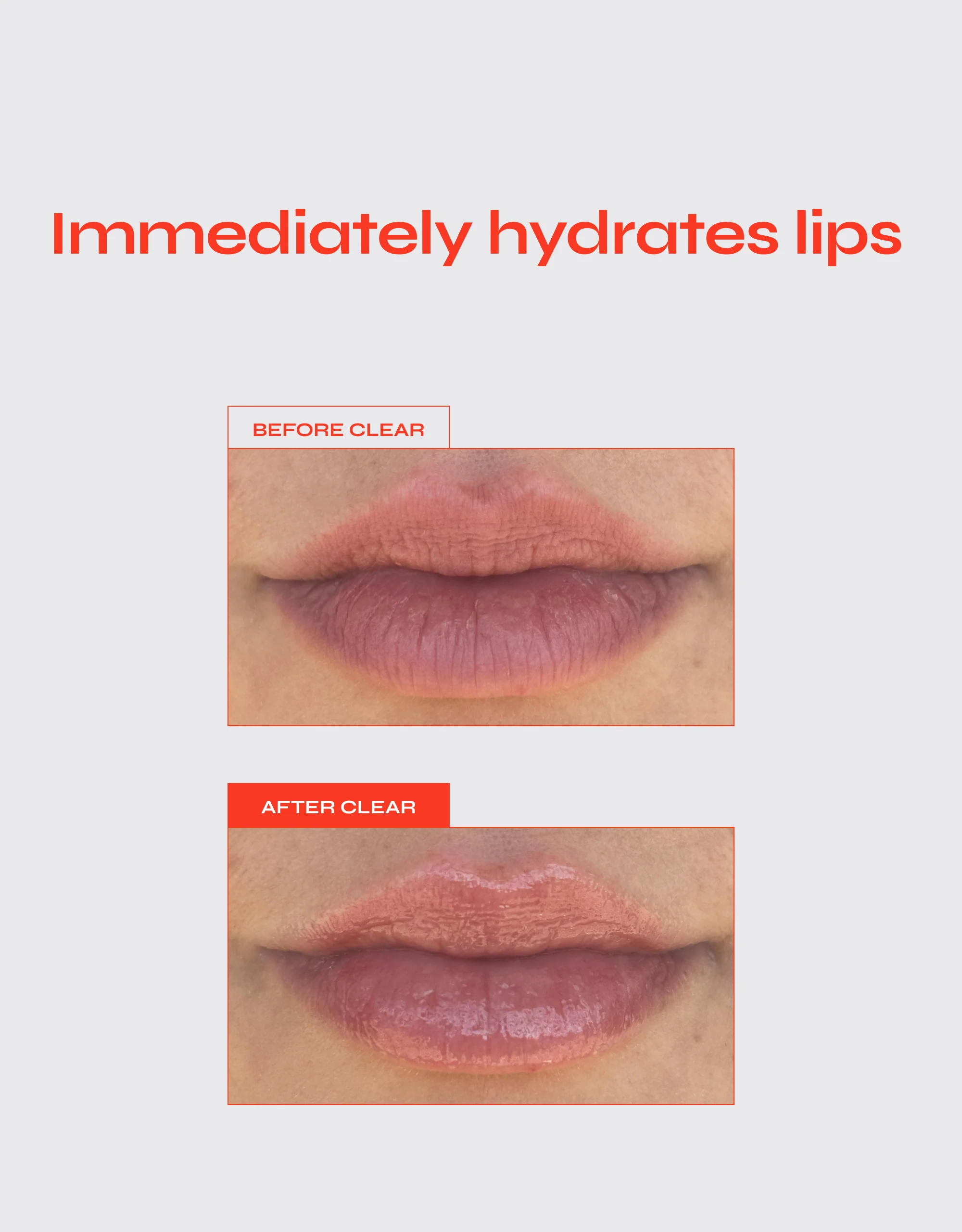 Lip Jelly - Image 6